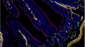Can Recombinant Antibodies Save You Time and Money in Lab?