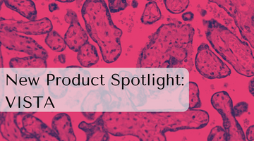 Product Highlight: Illuminating VISTA