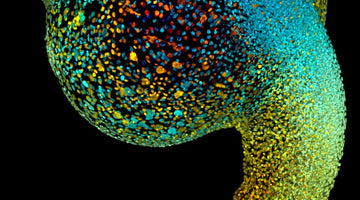 A Small Fish Plays a Big Role in Life Science Research