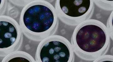 Broad Researcher’s Find SETDB1 Helps Tumors Evade the Immune System