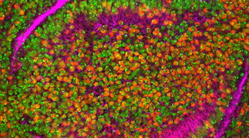 Nanobodies in the News