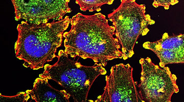 Publication Spotlight: Upregulation of miRNA‑301a‑3p Promotes Tumor Progression in Gastric Cancer by Suppressing NKRF and Activating NF‑κB Signaling