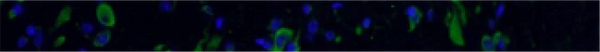 Recombinant Rabbit Monoclonals